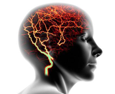 Epilepsie verursacht Klassifikationssymptomatik 